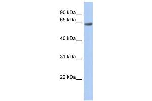 WB Suggested Anti-TBC1D10B Antibody Titration:  0. (TBC1D10B antibody  (Middle Region))