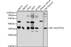 Western blot analysis of extracts of various cell lines, using B7-H4/VTCN1 antibody (ABIN6129975, ABIN6150157, ABIN6150158 and ABIN6214657) at 1:1000 dilution. (VTCN1 antibody  (AA 100-260))