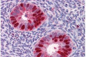 Human Uterus: Formalin-Fixed, Paraffin-Embedded (FFPE) (Deoxyuridine Triphosphatase (DUT) (AA 68-164) antibody)