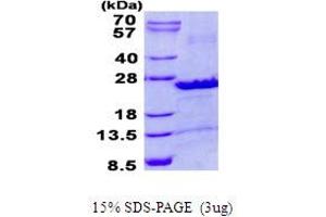 Image no. 1 for SEC22b Vesicle Trafficking Protein (SEC22B) protein (His tag) (ABIN1098677) (SEC22B Protein (His tag))