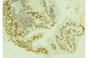 ABIN6277221 at 1/100 staining Mouse colon tissue by IHC-P.