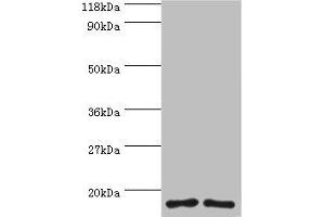 Western blot All lanes: RPS16 protein antibody at 2 μg/mL Lane 1: 293T whole cell lysate Lane 2: EC109 whole cell lysate Secondary Goat polyclonal to rabbit IgG at 1/15000 dilution Predicted band size: 17 kDa Observed band size: 17 kDa (RPS16 antibody  (AA 2-142))