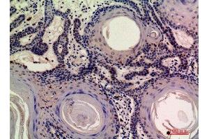 Immunohistochemical analysis of paraffin-embedded human-skin, antibody was diluted at 1:200 (MOBKL2A antibody  (N-Term))