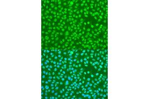 Immunofluorescence analysis of U2OS cells using HNRNPDL antibody (ABIN6127960, ABIN6141907, ABIN6141908 and ABIN6214947) at dilution of 1:100. (HNRPDL antibody  (AA 261-420))