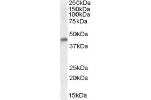 Western Blotting (WB) image for anti-NK2 Homeobox 5 (NKX2-5) (Internal Region) antibody (ABIN2464154) (NK2 Homeobox 5 antibody  (Internal Region))