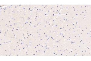 Detection of S100A8 in Bovine Esophagus Tissue using Polyclonal Antibody to S100 Calcium Binding Protein A8 (S100A8) (S100A8 antibody  (AA 1-89))