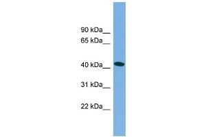 Western Blotting (WB) image for anti-Microtubule-Associated Protein tau (MAPT) (Middle Region) antibody (ABIN2783224)