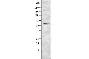 Western blot analysis OCT1 using K562 whole cell lysates (SLC22A1 antibody  (N-Term))