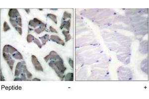 Immunohistochemical analysis of paraffin-embedded human muscle tissue using ACTG2 polyclonal antibody . (ACTG2 antibody)