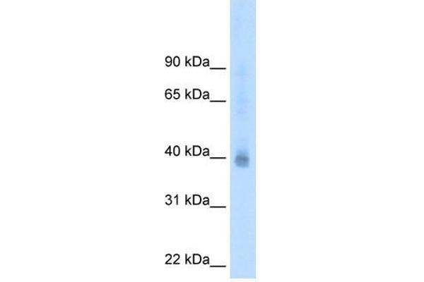 NR2F2 antibody  (N-Term)