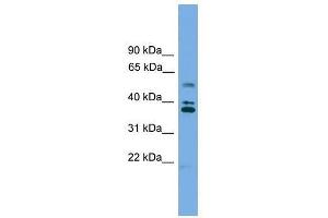 Western Blot showing LDLRAD3 antibody used at a concentration of 1-2 ug/ml to detect its target protein. (LDLRAD3 antibody  (Middle Region))