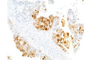 Immunohistochemistry (IHC) image for anti-Indoleamine 2,3-Dioxygenase 1 (IDO1) (AA 1-403) antibody (ABIN7449541) (Recombinant IDO1 antibody  (AA 1-403))