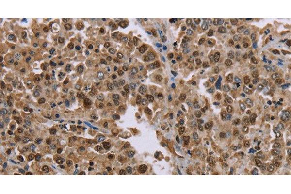 MRGPRX1 antibody