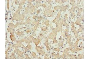 Immunohistochemistry of paraffin-embedded human liver tissue using ABIN7143362 at dilution of 1:100 (MOCS3 antibody  (AA 271-460))