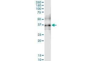 Immunoprecipitation of QPCT transfected lysate using anti-QPCT MaxPab rabbit polyclonal antibody and Protein A Magnetic Bead , and immunoblotted with QPCT purified MaxPab mouse polyclonal antibody (B01P) . (QPCT antibody  (AA 1-361))
