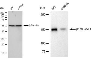 anti-Chromatin Assembly Factor 1, Subunit A (p150) (CHAF1A) antibody
