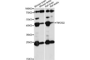 Western blot analysis of extracts of various cell lines, using TMOD2 antibody (ABIN6291659) at 1:1000 dilution.