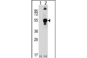 Western blot analysis of LECT1 (arrow) using rabbit polyclonal LECT1 Antibody (C-term) (ABIN389196 and ABIN2839359).