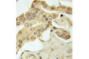 Immunohistochemistry (IHC) image for anti-Protein Kinase, AMP-Activated, alpha 1 Catalytic Subunit (PRKAA1) (AA 1-300) antibody (ABIN3021788) (PRKAA1 antibody  (AA 1-300))