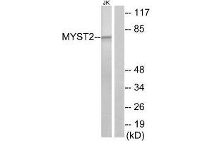 Western Blotting (WB) image for anti-MYST Histone Acetyltransferase 2 (MYST2) (Internal Region) antibody (ABIN1849062) (MYST2 antibody  (Internal Region))
