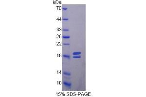 SDS-PAGE of Protein Standard from the Kit (Highly purified E. (MMP13 CLIA Kit)