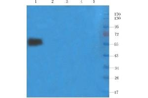 Western Blot using anti-IL2R alpha (CD25) antibody. (Recombinant IL2RA (Basiliximab Biosimilar) antibody)