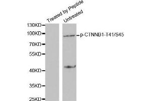 Western blot analysis of extracts from SW626 cells using Phospho-CTNNB1-T41/S45 antibody. (CTNNB1 antibody  (pSer45, pThr41))