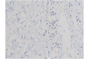 ABIN6267470 at 1/200 staining Human esophagus tissue sections by IHC-P. (AKT1 antibody  (pThr450))