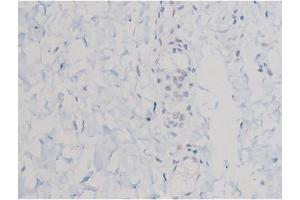 ABIN6267470 at 1/200 staining Human esophagus tissue sections by IHC-P. (AKT1 antibody  (pThr450))