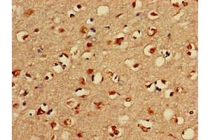 Immunohistochemistry of paraffin-embedded human brain tissue using ABIN7158354 at dilution of 1:100 (LIM Domain Kinase 1 antibody  (AA 179-320))