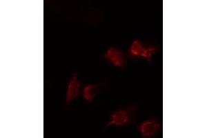 ABIN6274478 staining HepG2 cells by IF/ICC.