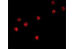 Immunofluorescent analysis of BOB1 staining in HT29 cells. (POU2AF1 antibody)