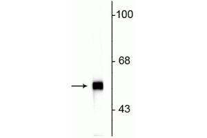 Western blot of rat cerebellar lysate showing specific immunolabeling of the ~57 kDa peripherin protein. (Peripherin antibody)