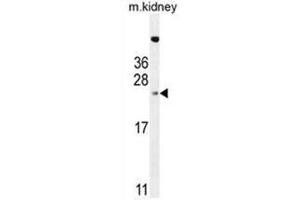 ADO Antibody (C-term) western blot analysis in mouse kidney tissue lysates (35µg/lane). (ADO antibody  (C-Term))