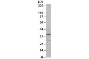 Western blot testing of HeLa lysate with ARPC2 antibody at 0. (ARPC2 antibody)