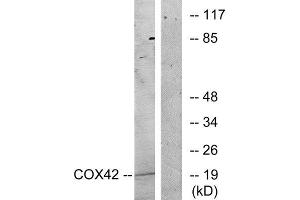 Western Blotting (WB) image for anti-Cytochrome C Oxidase Subunit IV Isoform 2 (Lung) (COX4I2) (Internal Region) antibody (ABIN1850324) (COX4I2 antibody  (Internal Region))