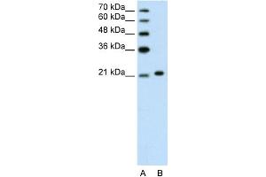 WB Suggested Anti-ANK1 Antibody Titration:  1. (Erythrocyte Ankyrin antibody  (C-Term))
