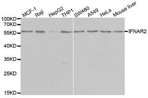 Western blot analysis of extracts of various cell lines, using IFNAR2 antibody. (IFNAR2 antibody  (AA 27-243))