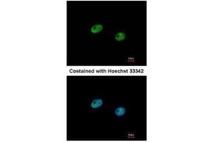 ICC/IF Image Immunofluorescence analysis of paraformaldehyde-fixed HeLa, using IRF5, antibody at 1:500 dilution. (IRF5 antibody  (C-Term))