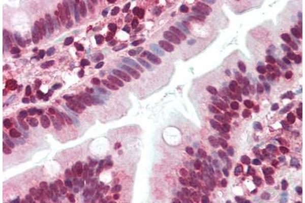 ZNF292 antibody