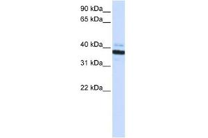 OAS1 antibody used at 1 ug/ml to detect target protein. (OAS1 antibody  (C-Term))