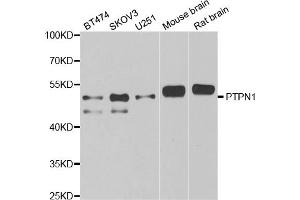 Western blot analysis of extracts of various cell lines, using PTPN1 antibody (ABIN5970769) at 1/1000 dilution.