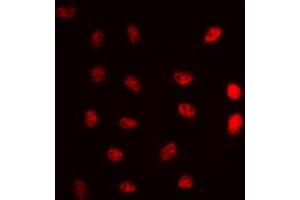 Immunofluorescent analysis of ERCC5 staining in A549 cells. (ERCC5 antibody  (N-Term))