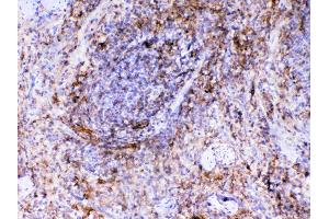 IHC analysis of VCAM1 using anti-VCAM1 antibody . (VCAM1 antibody  (AA 25-270))