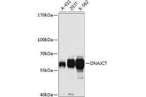 Western blot analysis of extracts of various cell lines, using DN antibody (ABIN3016674, ABIN3016675, ABIN3016676 and ABIN6219809) at 1:1000 dilution. (DNAJC7 antibody  (AA 230-380))