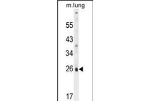 PQLC1 Antibody (Center) (ABIN654821 and ABIN2844494) western blot analysis in mouse lung tissue lysates (35 μg/lane). (PQLC1 antibody  (AA 100-128))