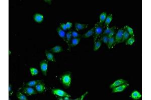 Immunofluorescence (IF) image for anti-Major Histocompatibility Complex, Class I, B (HLA-B) (AA 25-308) antibody (ABIN7155621)