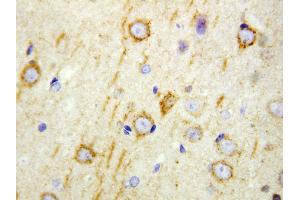 Anti-GAD65 antibody, IHC(P) IHC(P): Rat Brain Tissue