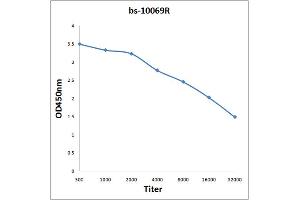 Antigen: 0. (IL-31 antibody  (AA 31-130))