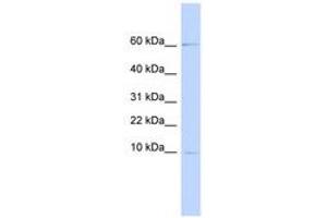 Image no. 1 for anti-Peptidase Inhibitor 3, Skin-Derived (PI3) (AA 36-85) antibody (ABIN6740924) (PI3 antibody  (AA 36-85))